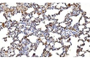 IHC analysis of LSM2 using anti-LSM2 antibody (ABIN7602832).