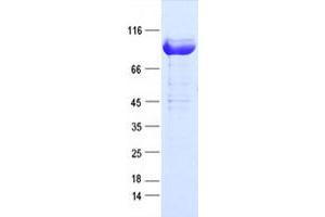 Validation with Western Blot