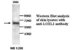 Image no. 1 for anti-Lysyl Oxidase-Like 1 (LOXL1) antibody (ABIN790876)