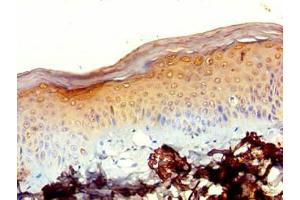 Immunohistochemistry of paraffin-embedded human skin tissue using ABIN7142373 at dilution of 1:100 (MRPL2 anticorps  (AA 46-149))