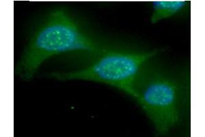 ICC/IF analysis of UBE2L6 in HeLa cells line, stained with DAPI (Blue) for nucleus staining and monoclonal anti-human UBE2L6 antibody (1:100) with goat anti-mouse IgG-Alexa fluor 488 conjugate (Green). (UbcH8/Ube2L6 (AA 1-152) anticorps)