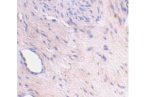 Immunohistochemical staining of human bladder tissue using AP30081PU-N ARMER antibody at 2 μg/ml.