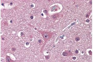 Human Brain, Cortex: Formalin-Fixed, Paraffin-Embedded (FFPE) (PPAT anticorps  (AA 42-278))