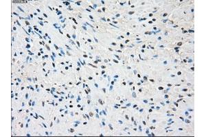 Image no. 2 for anti-Synovial Sarcoma, X Breakpoint 2 (SSX2) antibody (ABIN1501161) (SSX2 anticorps)