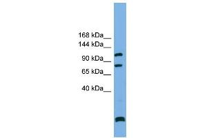 WB Suggested Anti-PPP6R1 Antibody Titration: 0. (SAPS1 anticorps  (N-Term))