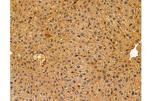 ABIN7095997 and ABIN7100059 at 1/100 staining mouse liver tissue by IHC-P.