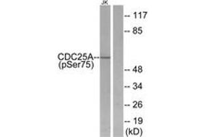 Western Blotting (WB) image for anti-Cell Division Cycle 25 Homolog A (S. Pombe) (CDC25A) (pSer75) antibody (ABIN2888378) (CDC25A anticorps  (pSer75))