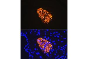 Immunofluorescence analysis of rat pancreas using Insulin Rabbit mAb (ABIN7267886) at dilution of 1:100 (40x lens). (Insulin anticorps)