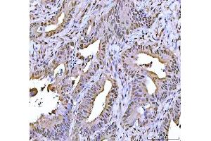 IHC analysis of FEN1 using anti-FEN1 antibody (ABIN7601617). (FEN1 anticorps  (AA 4-300))