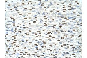 EXOSC4 antibody was used for immunohistochemistry at a concentration of 4-8 ug/ml to stain Myocardial cells (arrows) in Human Heart.