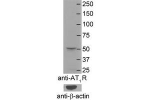 AGTR1 antibody - N-terminal region  validated by WB using Mouse Brain Membranes at 1:4000.
