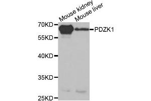 Western Blotting (WB) image for anti-PDZ Domain Containing 1 (PDZK1) antibody (ABIN1876509) (PDZK1 anticorps)