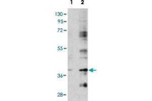 Western blot analysis of BIRC7 (arrow) using rabbit BIRC7 polyclonal antibody . (BIRC7 anticorps  (C-Term))