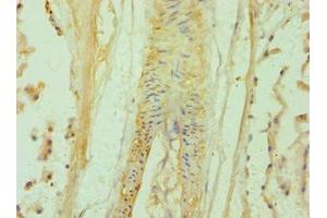 Immunohistochemistry of paraffin-embedded human prostate tissue using ABIN7145641 at dilution of 1:100 (BAMBI anticorps  (AA 21-152))