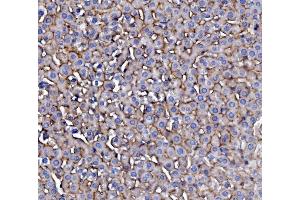 IHC analysis of EGFR using anti-EGFR antibody (ABIN7601478).