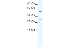 CAMK4 antibody (20R-1131) used at 1. (CAMK4 anticorps  (C-Term))
