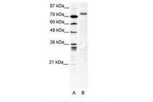 Image no. 1 for anti-Tripartite Motif Containing 9 (TRIM9) (C-Term) antibody (ABIN202749) (TRIM9 anticorps  (C-Term))
