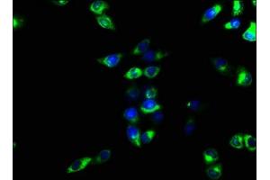 Immunofluorescence staining of Hela cells with ABIN7151367 at 1:166, counter-stained with DAPI. (CD39 anticorps  (AA 316-474))