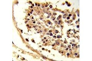 IHC analysis of FFPE human testis tissue stained with CXCR7 antibody