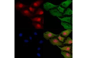 ABIN6257426 and ABIN6275552 staining  cells by IF/ICC.