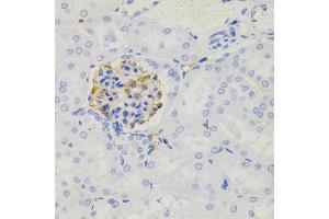 Immunohistochemistry of paraffin-embedded mouse kidney using NPHS1 antibody (ABIN5971560) (40x lens). (Nephrin anticorps)