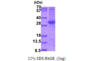 SDS-PAGE (SDS) image for Mitogen-Activated Protein Kinase Kinase 6 (MAP2K6) (AA 53-314) protein (His tag) (ABIN6387535)