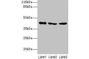 Western blot All lanes: ATXN3 antibody at 2 μg/mL Lane 1: 293T whole cell lysate Lane 2: Mouse brain tissue Lane 3: MCF-7 whole cell lysate Secondary Goat polyclonal to rabbit IgG at 1/10000 dilution Predicted band size: 42, 36, 40, 21 kDa Observed band size: 42 kDa (Ataxin 3 anticorps  (AA 1-288))