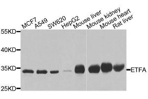 Western blot analysis of extracts of various cell lines, using ETFA antibody. (ETFA anticorps  (AA 1-333))