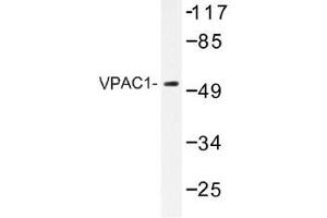 Image no. 1 for anti-Vasoactive Intestinal Peptide Receptor 1 (VIPR1) antibody (ABIN317871) (VIPR1 anticorps)