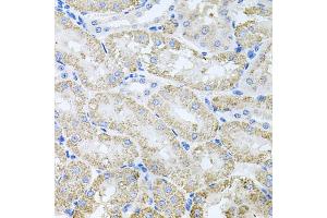 Immunohistochemistry of paraffin-embedded mouse kidney using TARS antibody (ABIN5974207) at dilution of 1/100 (40x lens). (TARS anticorps)