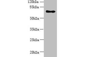 Western blot All lanes: ZNF133 antibody at 5 μg/mL + Hela whole cell lysate Secondary Goat polyclonal to rabbit IgG at 1/10000 dilution Predicted band size: 74, 63, 67 kDa Observed band size: 74 kDa (ZNF133 anticorps  (AA 1-210))