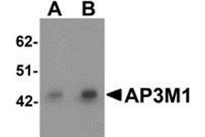 Western blot analysis of AP3M1 in human brain tissue lysate with AP3M1 antibody at (A) 1 and (B) 2 μg/ml. (AP3M1 anticorps  (C-Term))