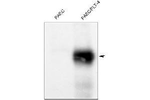 Western Blotting (WB) image for anti-Fms-Related Tyrosine Kinase 4 (FLT4) antibody (ABIN567980) (FLT4 anticorps)