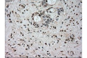 Image no. 10 for anti-Neurotrophic tyrosine Kinase, Receptor, Type 3 (NTRK3) antibody (ABIN1499842)