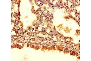 Immunohistochemistry of paraffin-embedded human lung tissue using ABIN7144175 at dilution of 1:100 (ASB1 anticorps  (AA 1-300))