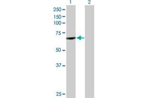 Western Blot analysis of CYP11B1 expression in transfected 293T cell line by CYP11B1 MaxPab polyclonal antibody.