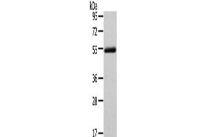 Western Blot analysis of Human normal liver tissue using FOXC1 Polyclonal Antibody at dilution of 1/400 (FOXC1 anticorps)