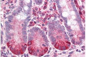 Human Small Intestine (formalin-fixed, paraffin-embedded) stained with IL8RB antibody ABIN337037 at 2. (CXCR2 anticorps)