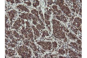 Image no. 6 for anti-Family with Sequence Similarity 164, Member A (FAM164A) antibody (ABIN1498198) (FAM164A anticorps)