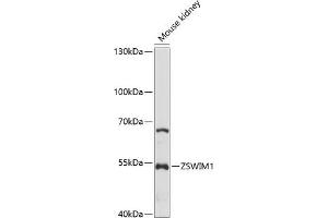Western blot analysis of extracts of mouse kidney, using ZSWIM1 antibody (ABIN7271563) at 1:1000 dilution. (ZSWIM1 anticorps  (AA 411-485))