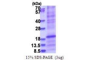 SDS-PAGE (SDS) image for Surfactant Protein D (SFTPD) (AA 224-375) protein (His tag) (ABIN5853770)