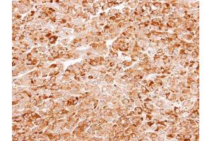 IHC-P Image Immunohistochemical analysis of paraffin-embedded CL1-5 xenograft, using AKR7A3, antibody at 1:100 dilution. (AKR7A3 anticorps)