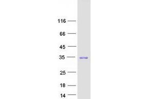 Validation with Western Blot