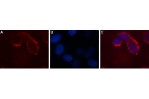Expression of Ghrelin receptor in human SH-SY5Y cell line - Cell surface detection of Ghrelin receptor in intact living human neuroblastoma (SH-SY5Y) cells.
