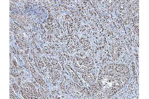 IHC analysis of TRMT6 using anti-TRMT6 antibody (ABIN7602138). (TRMT6 anticorps  (AA 6-489))