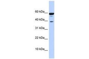 Image no. 1 for anti-Protein Phosphatase 1, Regulatory Subunit 8 (PPP1R8) (AA 215-264) antibody (ABIN6740668) (PPP1R8 anticorps  (AA 215-264))