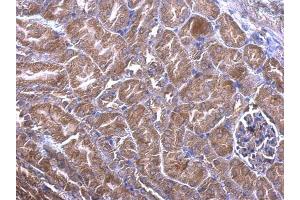 IHC-P Image PHLP antibody detects PHLP protein at cytoplasm on mouse kidney by immunohistochemical analysis.