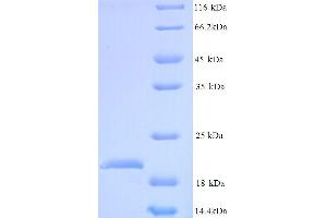SDS-PAGE (SDS) image for GC-Rich Promoter Binding Protein 1-Like 1 (GPBP1L1) (AA 2-169) protein (His tag) (ABIN5713718)