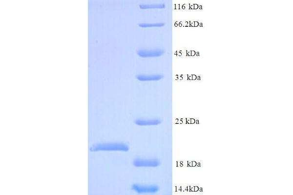GPBP1L1 Protein (AA 2-169) (His tag)