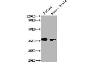 Western Blot Positive WB detected in: Jurkat whole cell lysate, Mouse Brain tissue All lanes: OR51F2 antibody at 1:2000 Secondary Goat polyclonal to rabbit IgG at 1/50000 dilution Predicted band size: 39 kDa Observed band size: 39 kDa (OR51F2 anticorps  (AA 324-336))